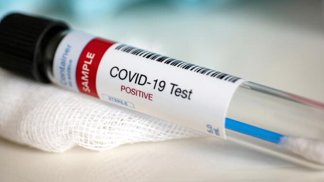 China hace obligatorio las pruebas anales de covid-19 a extranjeros, los médicos responden a la polémica